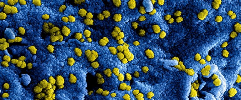 Microscopisch beeld van een virus-infectie